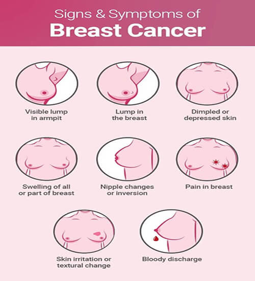 Top Breast Cancer Doctor Specialist Delhi NCR India